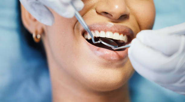 Best Walk-In Emergency Dentist in East Sparta, OH