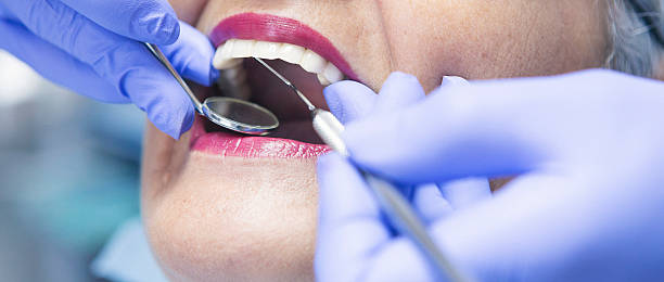 Best Emergency Tooth Extraction in East Sparta, OH